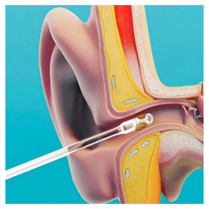 Ear Warning Removal Tool, Earwax Remover for Elderly Adults